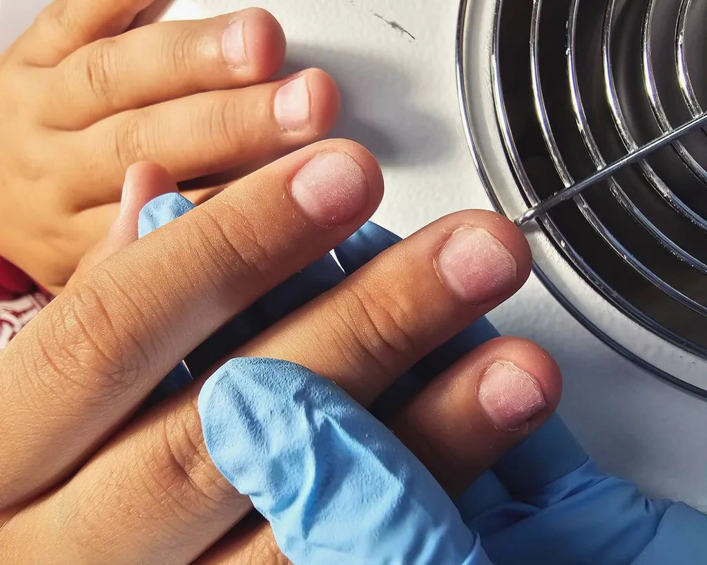 Manikiūras ir Pedikiūras 7 Nago korekcija atliekama grožio salone Elegansuus Vilkaviškyje