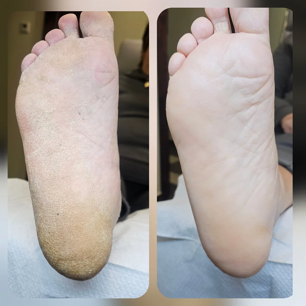 Manikiūras ir Pedikiūras 8 Rezultatas po Elegansuus salone atlikto pedikiūro