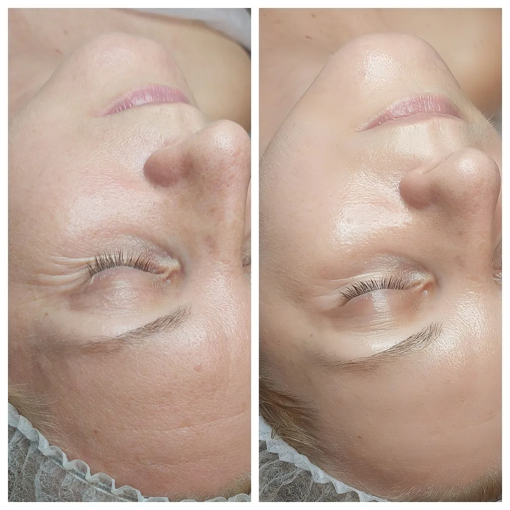 Kosmetologijos Paslaugos 16 Skaistinančios ir senėjimą lėtinančios procedūros rezultatai